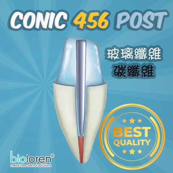 Conic 456 post玻璃纖維/碳纖維根管柱 (4-5-6%)